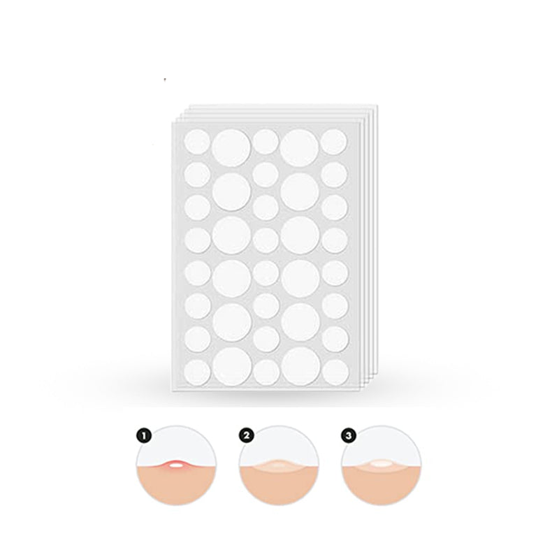Glamorous Face Acne Pimple Patch 72 Patches